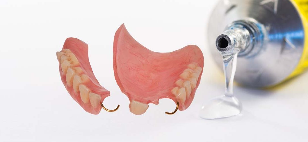 Why you should never superglue a broken denture